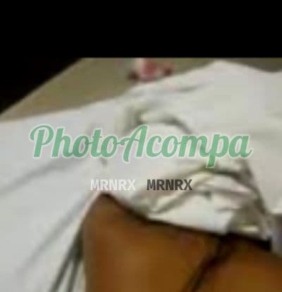 Acompanhante em Campo Grande com beijo grego (2) — Mirella